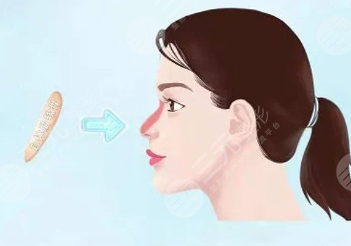 鼻梁山根低怎么辦？