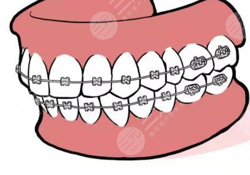 牙齒矯正什么年齡段好？