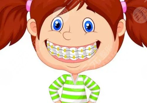 牙齒矯正用隱形牙套還是鋼絲牙套好？