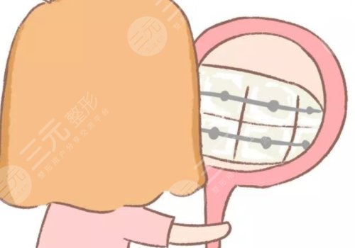 牙齒矯正用隱形牙套還是鋼絲牙套好？