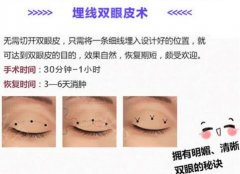 埋線雙眼皮注意事項(xiàng)有哪些？美眼必修課超全講解！