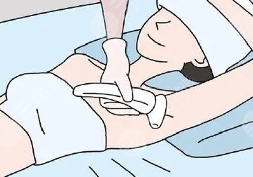 脫毛儀哪個牌子效果比較好？