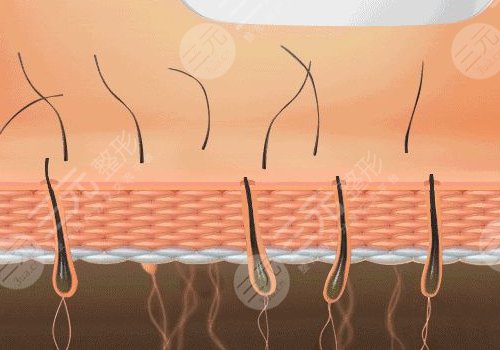 脫毛儀哪個牌子效果比較好？