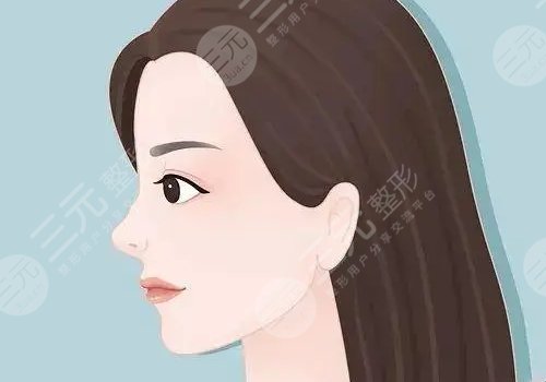 玻尿酸隆鼻子可以維持多久？