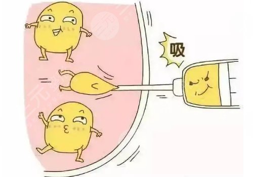 吸脂瘦腿會(huì)反彈嗎？