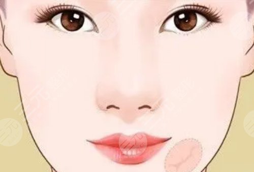 像素射頻儀器祛疤有用嗎？