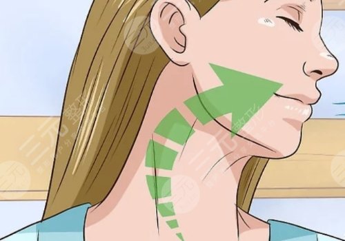 頸紋特別深怎么去除？