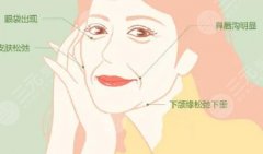 輪廓固定做什么項目？醫(yī)美抗衰新潮流，深入了解！