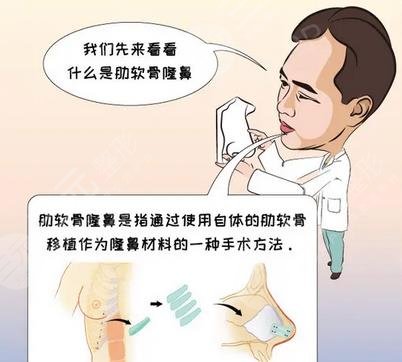 半肋骨鼻能維持幾年？