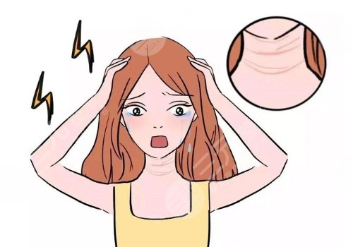 頸紋是什么原因造成的？