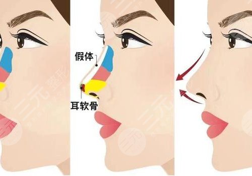 長沙貝美醫(yī)療美容正規(guī)嗎?