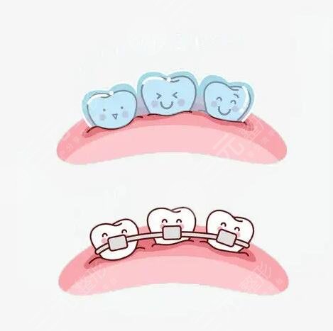 22歲牙齒矯正大概多少錢?