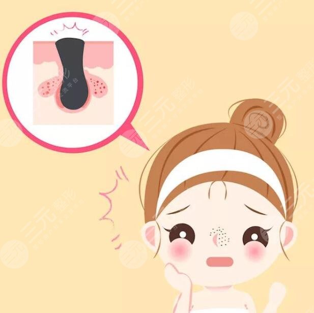 如何收縮鼻頭毛孔粗大小妙招