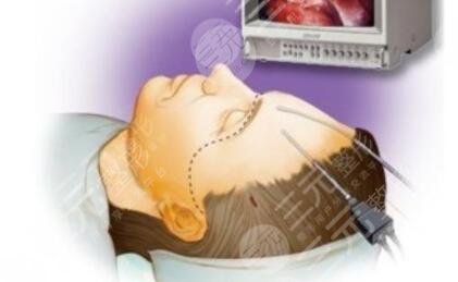 八大處整形醫(yī)院開展項(xiàng)目