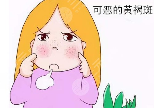 怎樣去除面部黃褐斑有效？