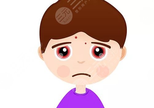 臉上有痘印怎么辦才能去掉呢？