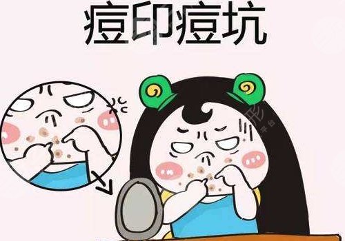 臉上有痘印怎么辦才能去掉呢？