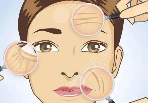 彩光嫩膚和光子嫩膚有什么區(qū)別？