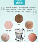 像素激光有用嗎？?jī)?yōu)點(diǎn)原理介紹，高性?xún)r(jià)比美膚之選！