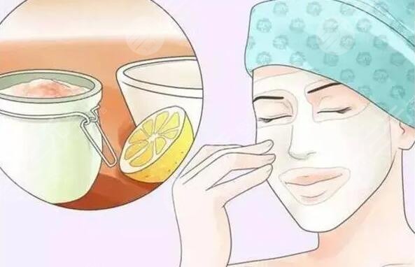 果酸煥膚有沒有副作用?