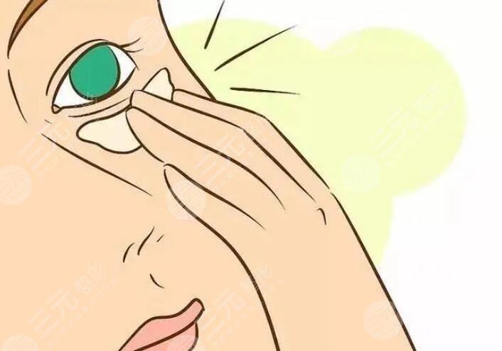 怎樣防止魚(yú)尾紋及保養(yǎng)方法