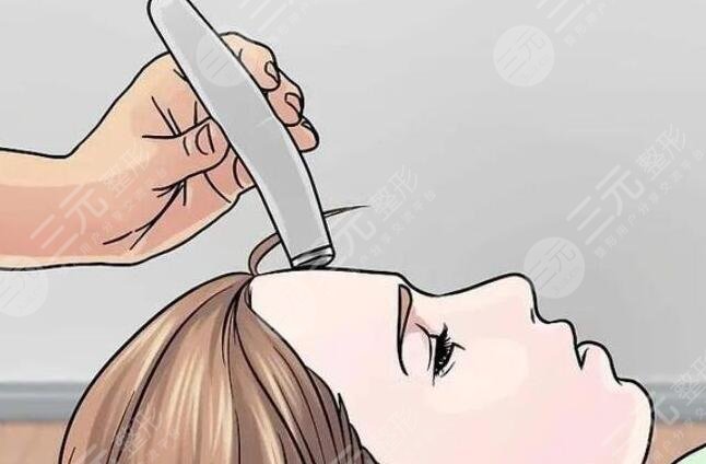 光子嫩膚后有哪些注意事項?