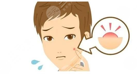 緩解青春痘費用多少錢？哪些醫(yī)美方法見效快？