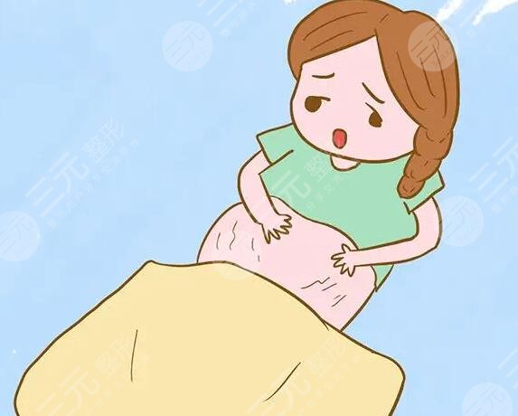 5個(gè)妙招幫助消除妊娠紋