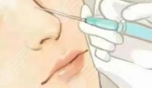 玻尿酸隆鼻價(jià)格是多少