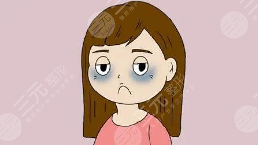 怎樣能夠幫助減輕黑眼圈呢?