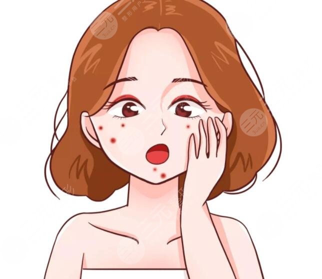 祛痘有效方法有效可行，護(hù)理注意事項(xiàng)|內(nèi)調(diào)