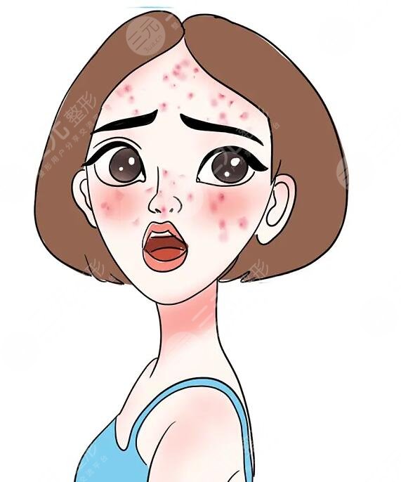 生長(zhǎng)痘痘如何護(hù)理?