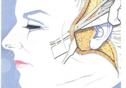 多維除皺真的有用嗎？