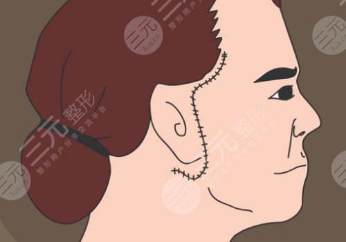 多維除皺真的有用嗎？