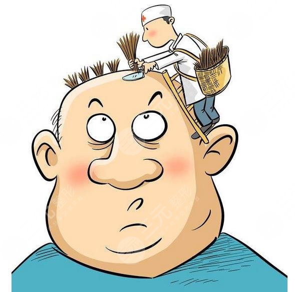 禿頂植發(fā)需要多少錢