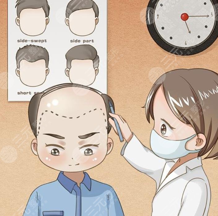 禿頂植發(fā)需要多少錢