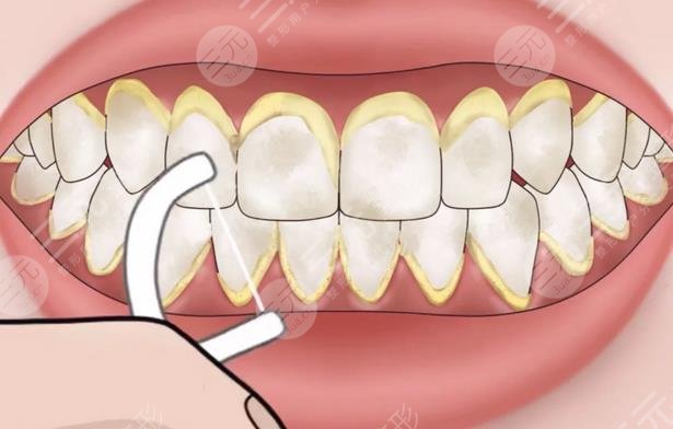 牙齒發(fā)黃變白的方法有哪些