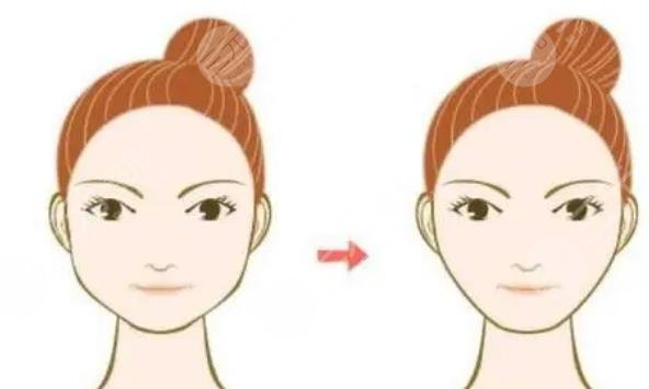 磨骨瘦臉多少費(fèi)用