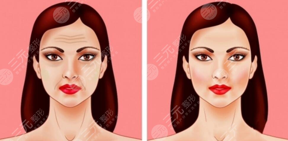 做了筋膜重整能夠維持多長(zhǎng)時(shí)間?