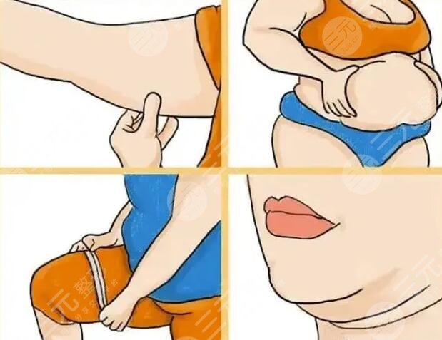 光纖溶脂是怎么做的?