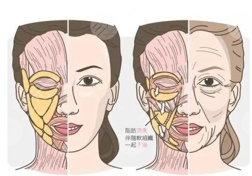 熱瑪吉是單頻還是雙頻？