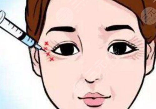 注射除皺眼部效果好嗎？