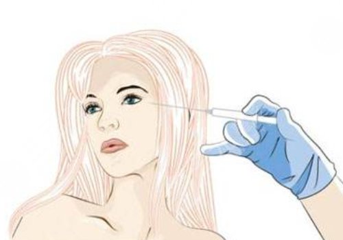 注射除皺眼部效果好嗎？