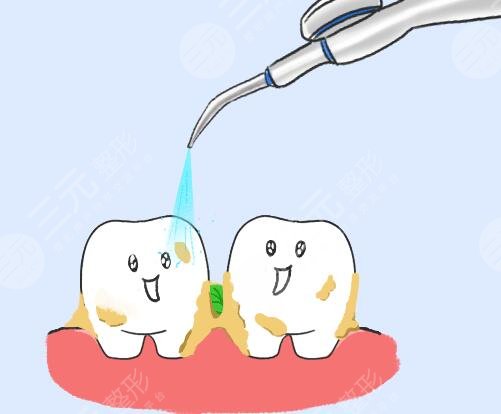 冷光美白牙齒好嗎?