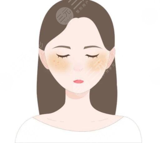 去除黃褐斑價(jià)格大概是多少？哪種方式祛斑見效快！