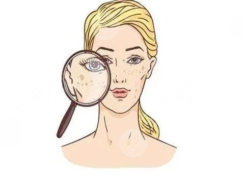 激光祛斑術(shù)后注意事項(xiàng)有哪些?