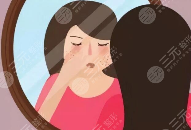 去除黃褐斑價(jià)格大概是多少?