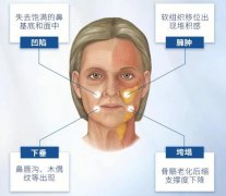 皮膚松弛了怎么辦？緊膚除皺，6個妙計(jì)分享！