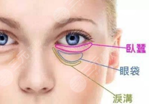 多維平復祛眼袋是什么？