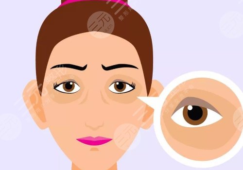 多維平復祛眼袋是什么？